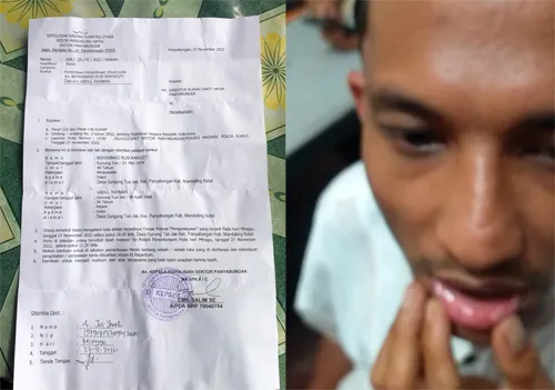 Kapolsek Usut Warga Gunungtuajae Dipukul