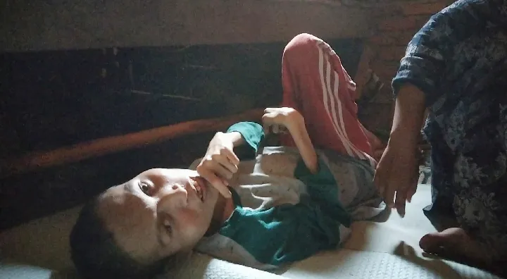 Tubuh Pemuda Panyabungan Mengecil Dan Lumpuh