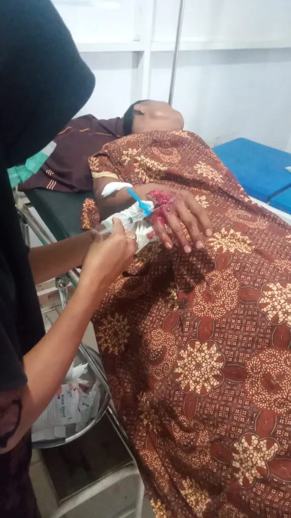 Istri Diterkam Buaya, Suami Melawan