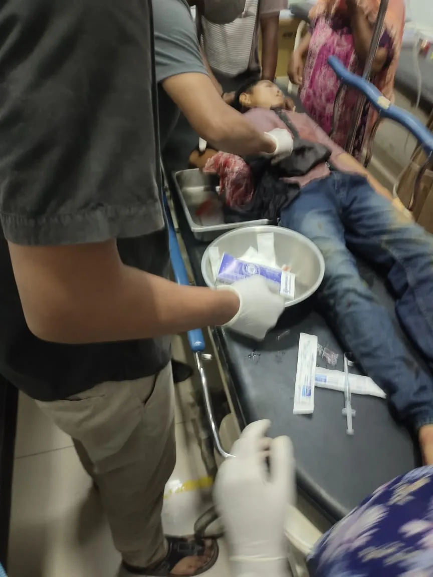 Warga Natal Luka Parah Diterkam Buaya