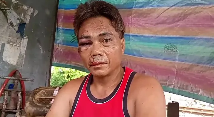 Suami Istri Jadi Korban Begal Sadis Di Belawan