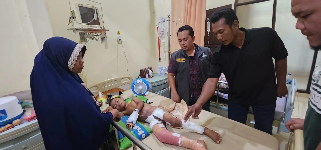 Ketua HIPMI Palas Jenguk Dan Bantu Korban Luka Bakar di Rumah Sakit