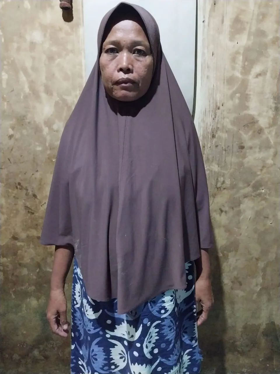 Bu Misna Lubis Idap Hiperplasia Endometrium, Perut Membengkak