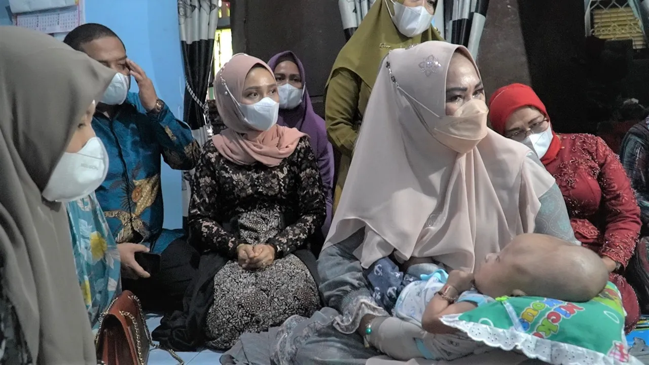 Ketua PKK Langkat Bantu Balita Penderita Hidrosefanus
