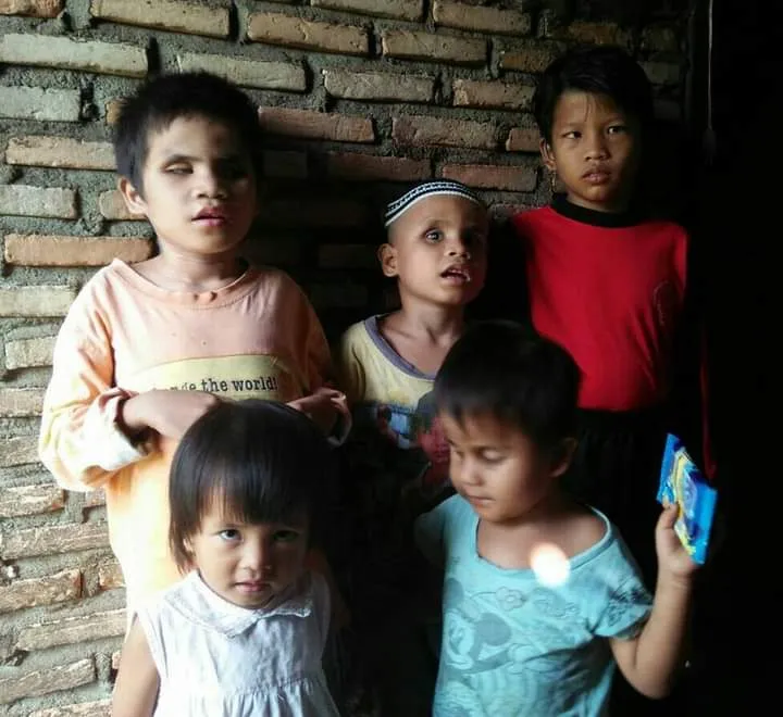 Anak Pidolidolok Sekeluarga Buta Total, Mohon Bantuan