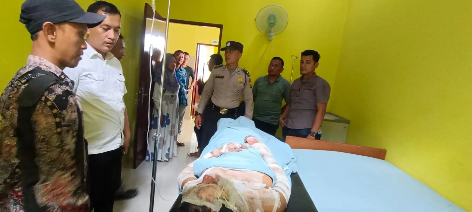 Akibat Cemburu, Suami Bakar Istri