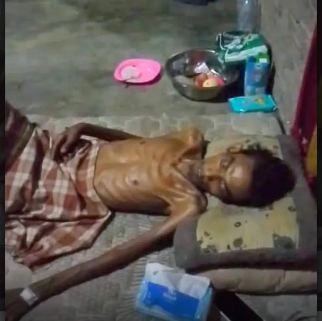 Tangis Seorang Ayah di Batu Bara, Punya BPJS Tapi Tak Punya Ongkos Bawa Anak ke Rumah Sakit