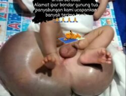 Bayi Penderita Spina Bifida, Butuh Bantuan Dermawan