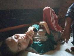 Tubuh Pemuda Panyabungan Mengecil Dan Lumpuh