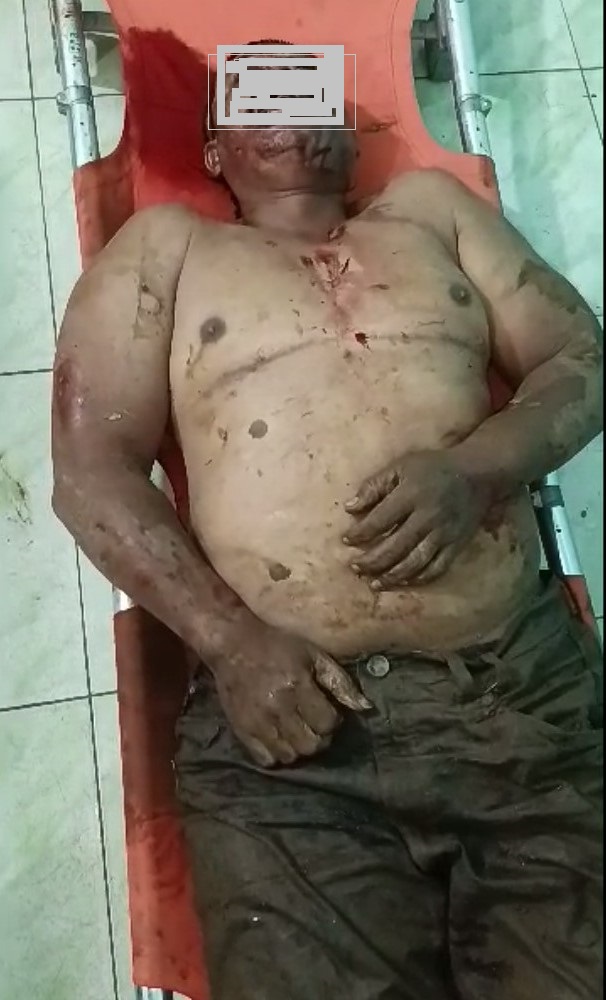 Teks fhoto: Tersangka maling kambing diamuk masa meninggal di Batu Bara Senin (12/6-2023) malam.beritasore/alirsyah