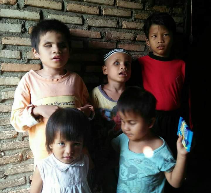 Teks foto Tiga anak dikabarkan menderita disabilitas tunanetra total, dua anak [maaf] juling berat. Berita/Ist