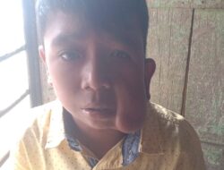 Anak Panyabungan Timur Hendak Operasi, Tak Ada Biaya