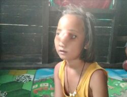 Kemensos Bantu Bocah Simangambat  Berobat Ke RSUP Adam Malik Medan