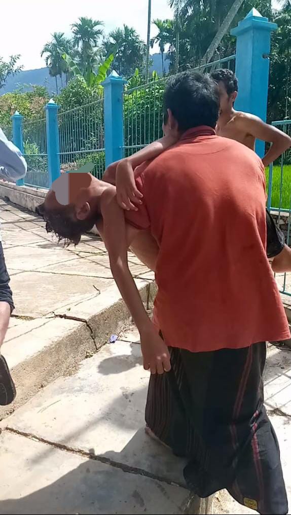 Teks foto: Bocah berusia 11 tahun dilarikan ke RSUD Panyabungan, setelah dibacok pria diduga kurang waras.