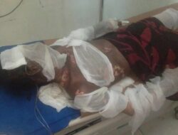 Dituduh Curi Hp, Deni Kritis Dibakar Di Perumnas Mandala