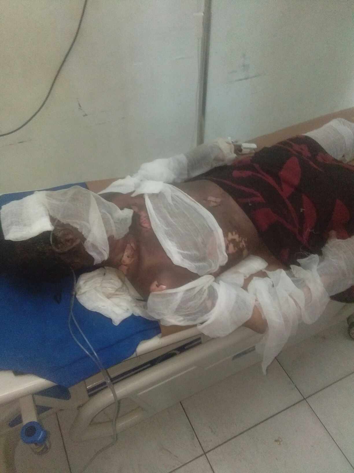 Berita Sore/Ist Deni saat masih dirawat di RS Muhammadiyah akibat tubuhnya gosong dibakar 2 pria, Rabu (25/10) sore.