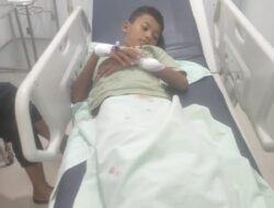 Monyet Liar Kembali Serang Remaja 11 Tahun