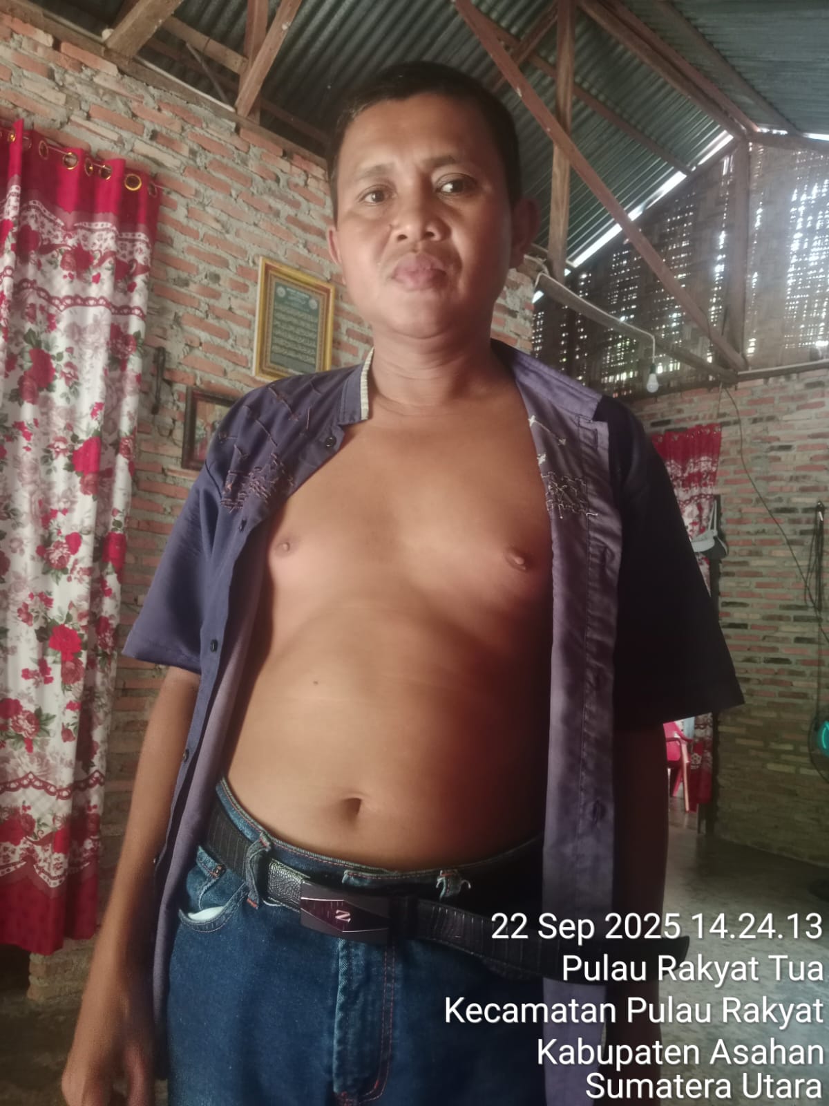 Jumirin salah seorang korban tersengat listrik PT. PLN. (Berita Sore/Paimin)